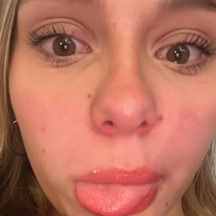 @estoesterrible0