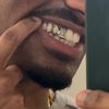 15dvs