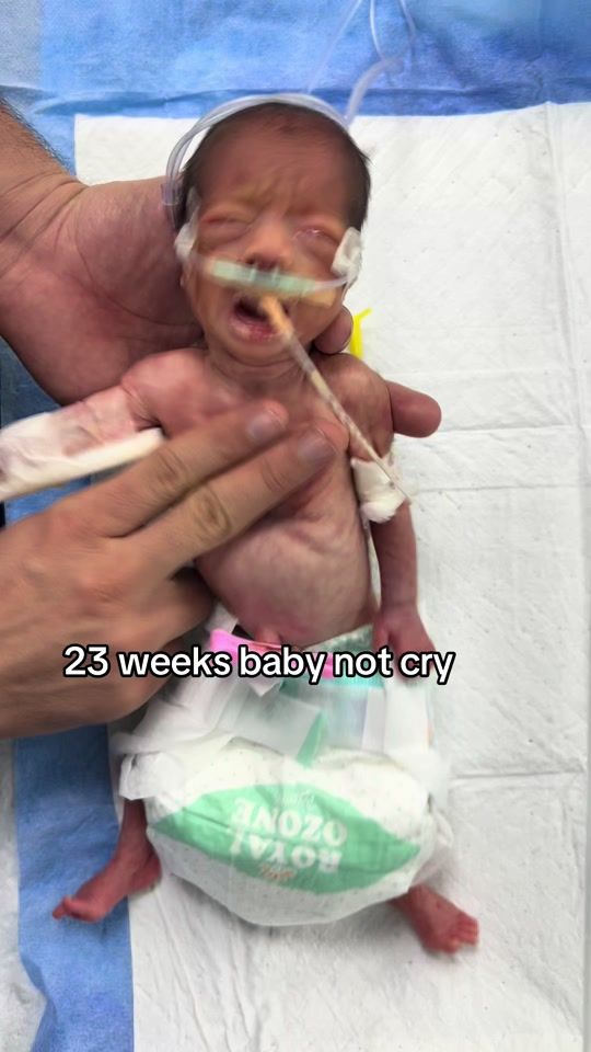 TikTok video thumbnail by newborn24h