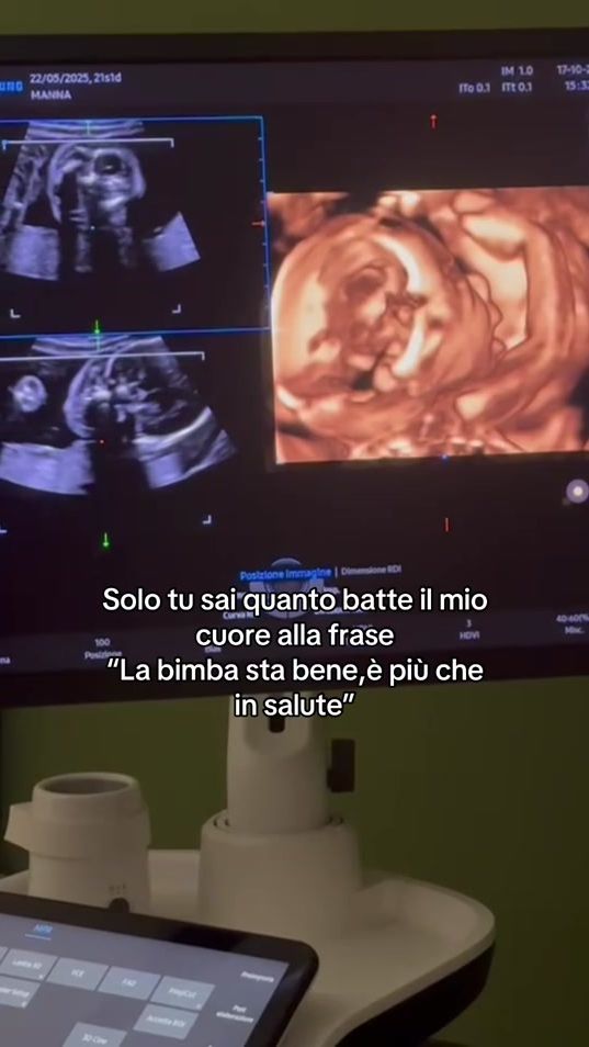 TikTok video thumbnail by daniela_soraya4