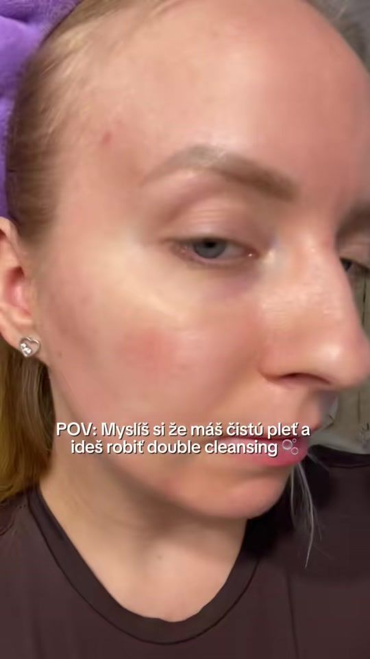TikTok video thumbnail by glowy.skin.calling