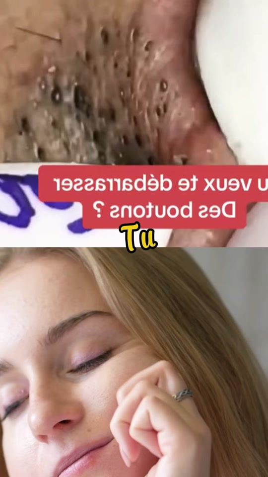 TikTok video thumbnail by vitalite_01
