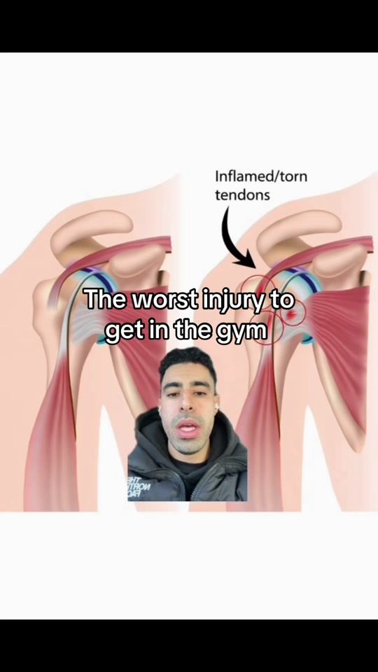 TikTok video thumbnail by ash.thephysio