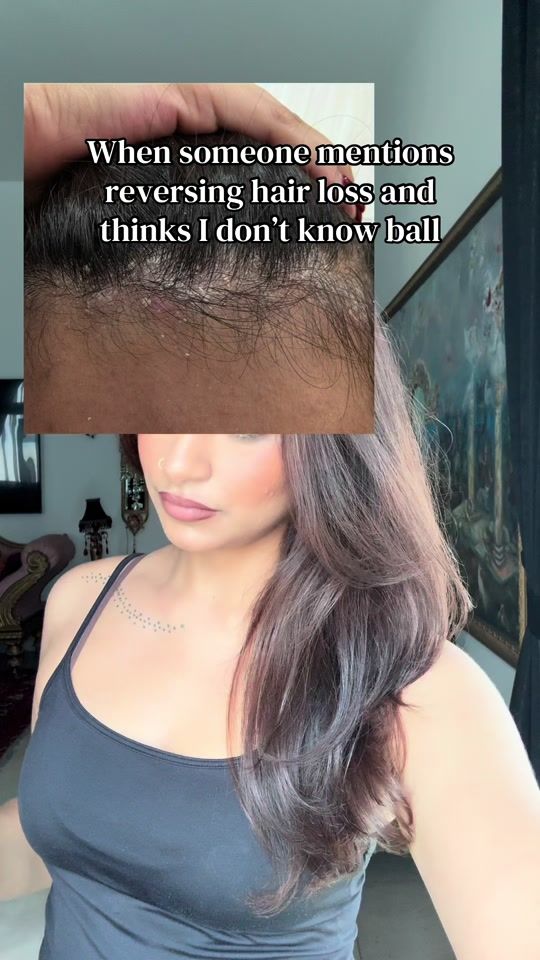 TikTok video thumbnail by shr9ddha