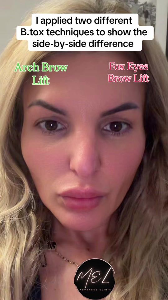 TikTok video thumbnail by meladvancedclinic