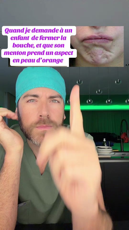 TikTok video thumbnail by dr.never