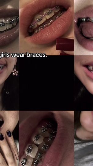TikTok video thumbnail by get_braces
