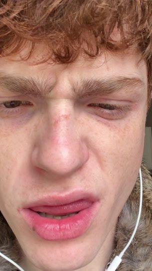 TikTok video thumbnail by _.rossomalpelo._