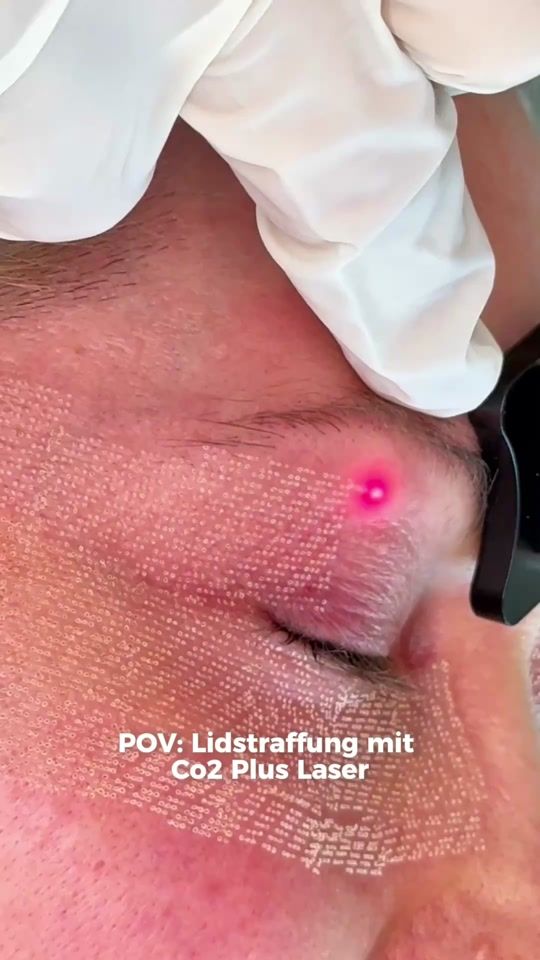 TikTok video thumbnail by lucerne_clinic