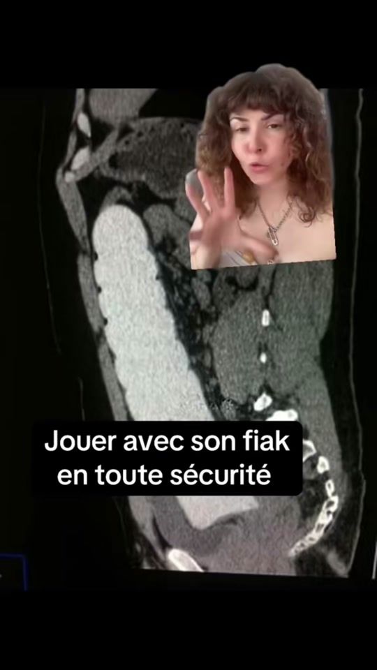 TikTok video thumbnail by wicul_