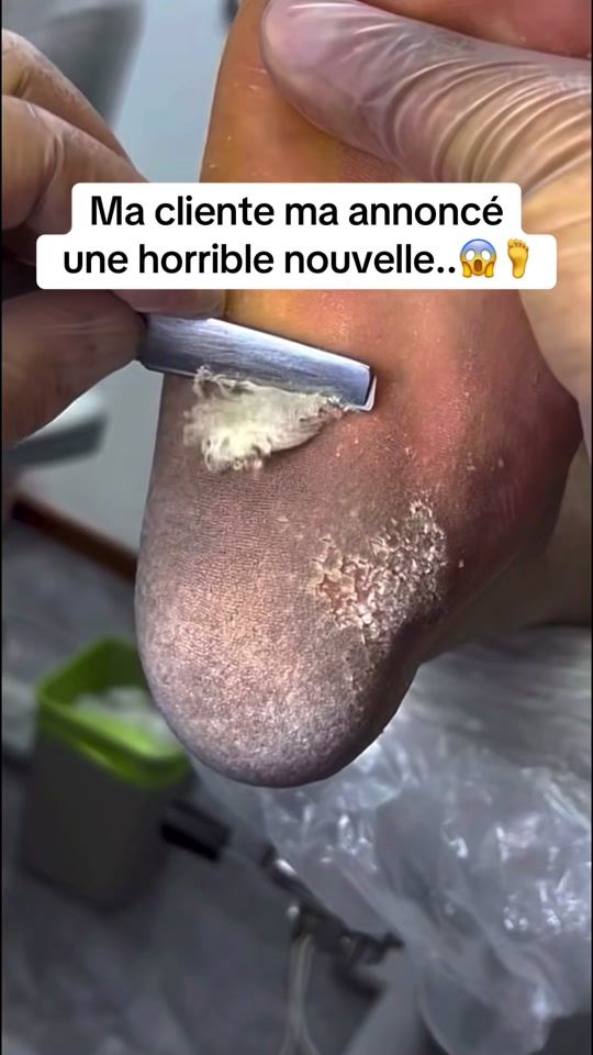 TikTok video thumbnail by max_quizzfr
