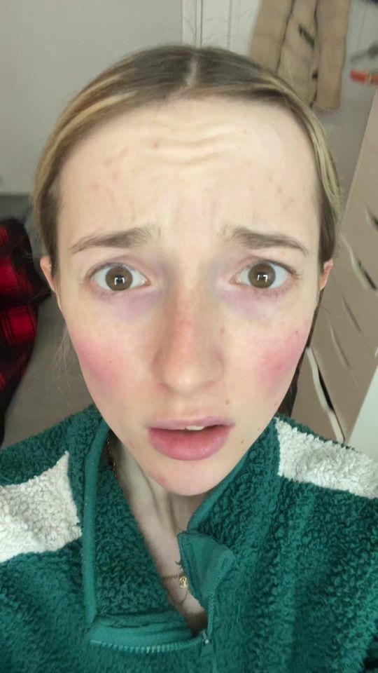 TikTok video thumbnail by xgiselaaa