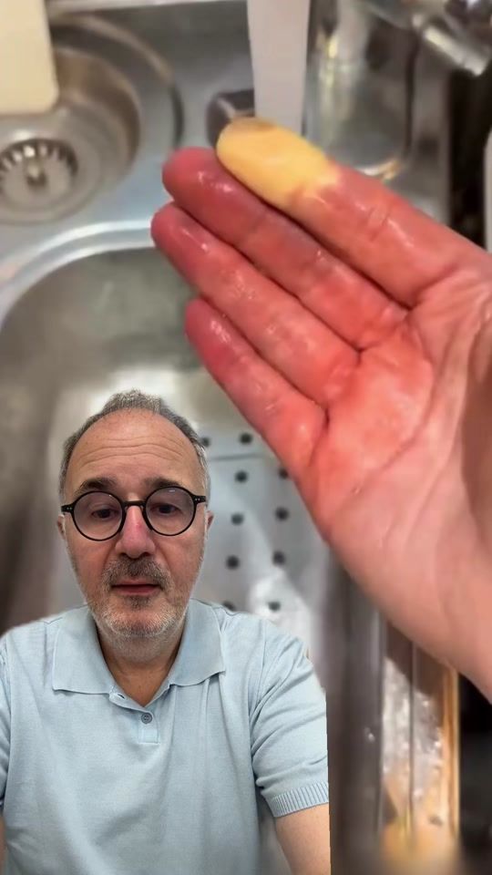 TikTok video thumbnail by drtik_tok