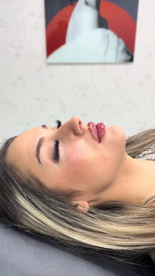 TikTok video thumbnail by dr.youssef_majed