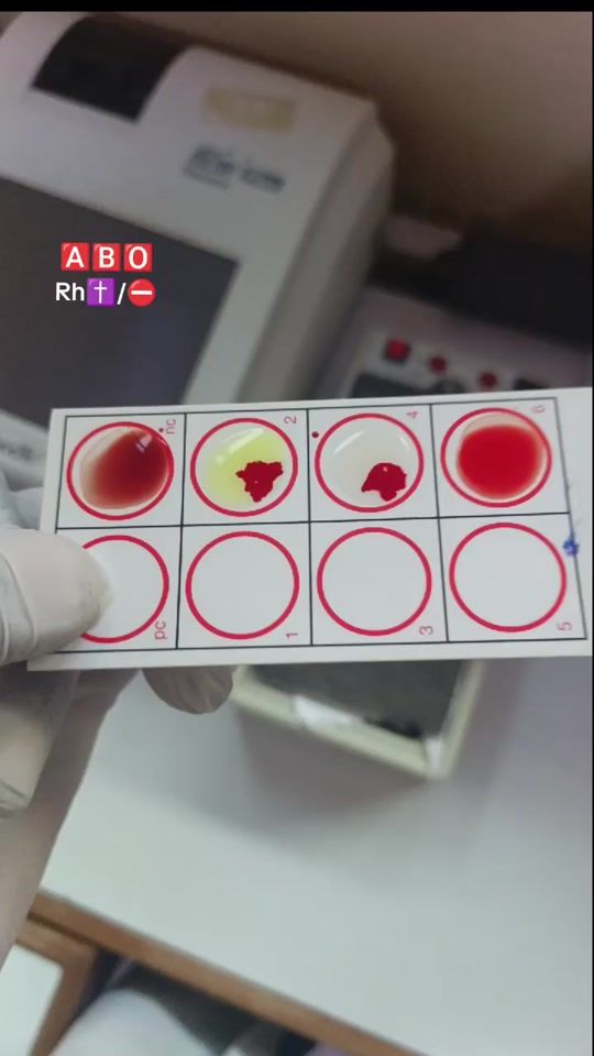 TikTok video thumbnail by biologiste.modest