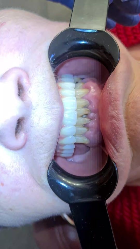 TikTok video thumbnail by dr.samedzeineddin