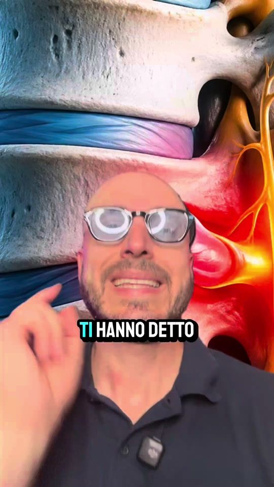 TikTok video thumbnail by dott.capello