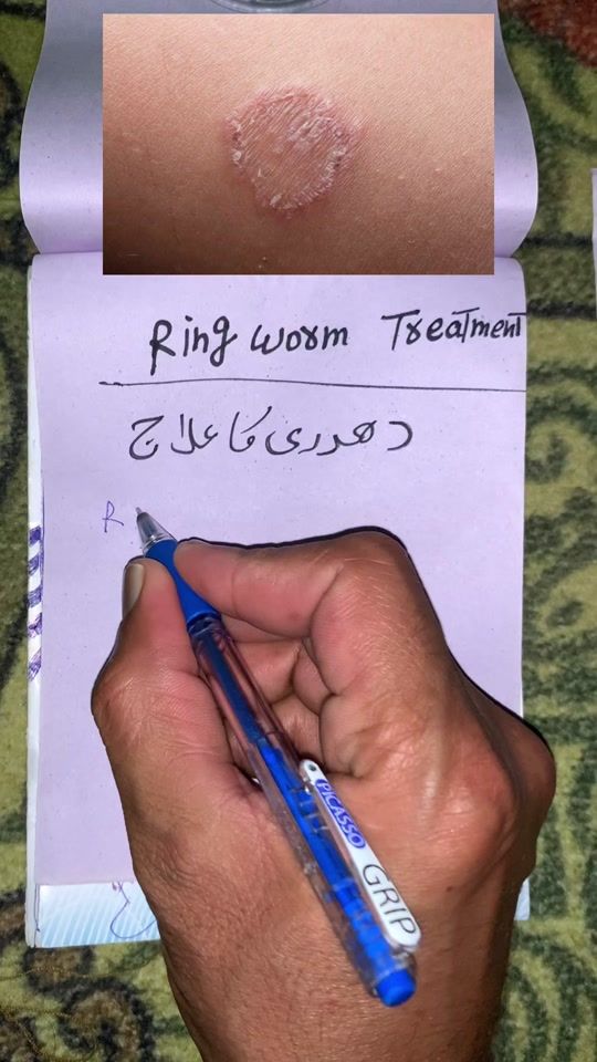 TikTok video thumbnail by doctorinformation2
