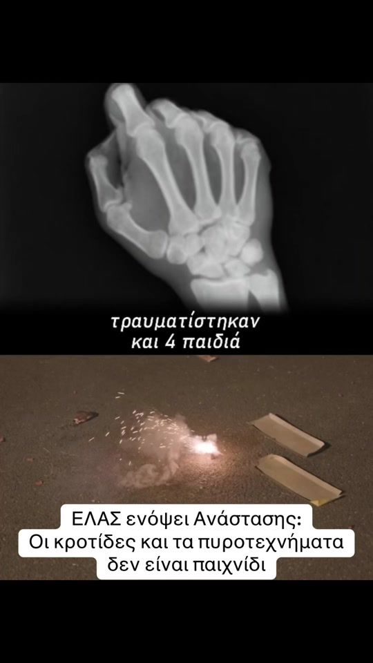 TikTok video thumbnail by dionisisvorgias