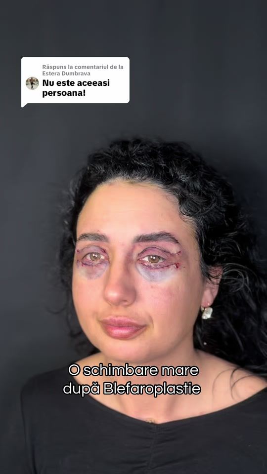 TikTok video thumbnail by legacy_med