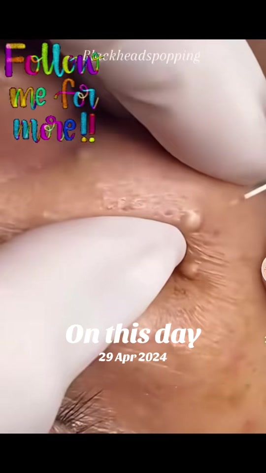 TikTok video thumbnail by only1diane