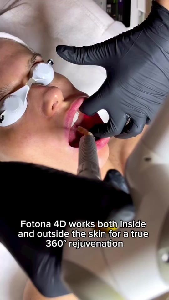 TikTok video thumbnail by aestha_clinic