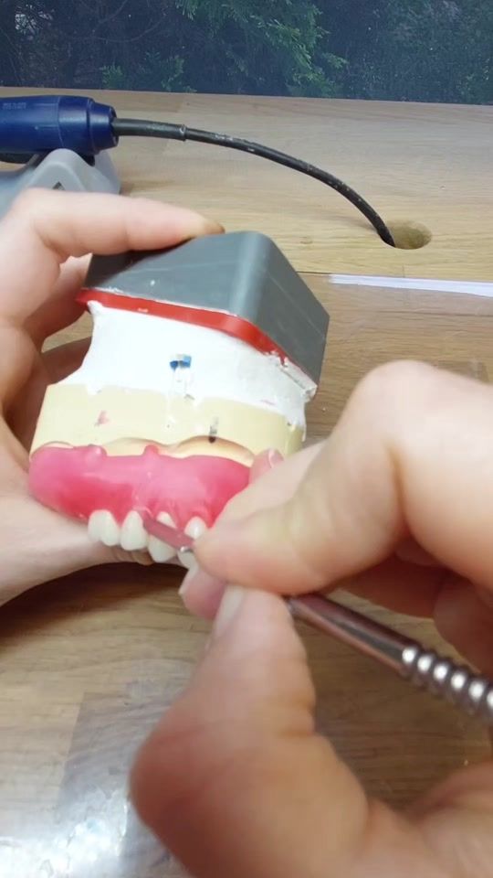 TikTok video thumbnail by chorna.tdent