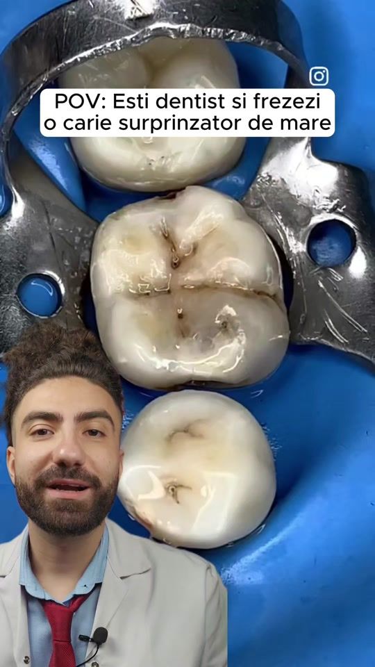 TikTok video thumbnail by dr.teddystroe