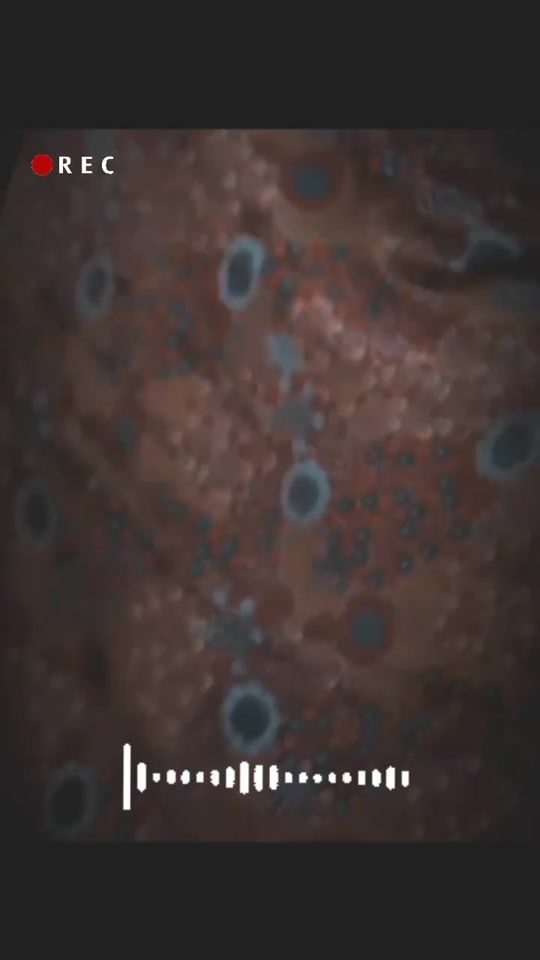 TikTok video thumbnail by music_univercel