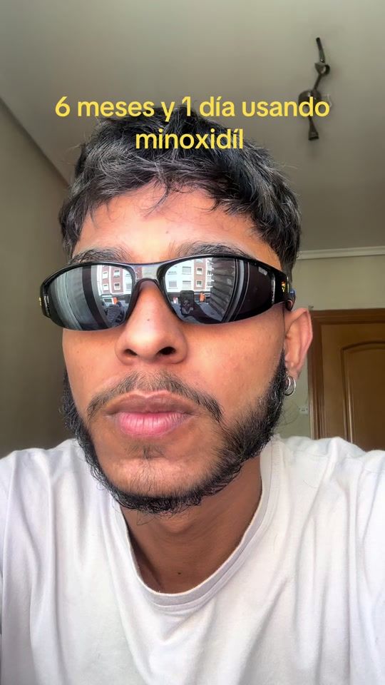 TikTok video thumbnail by popila_borola
