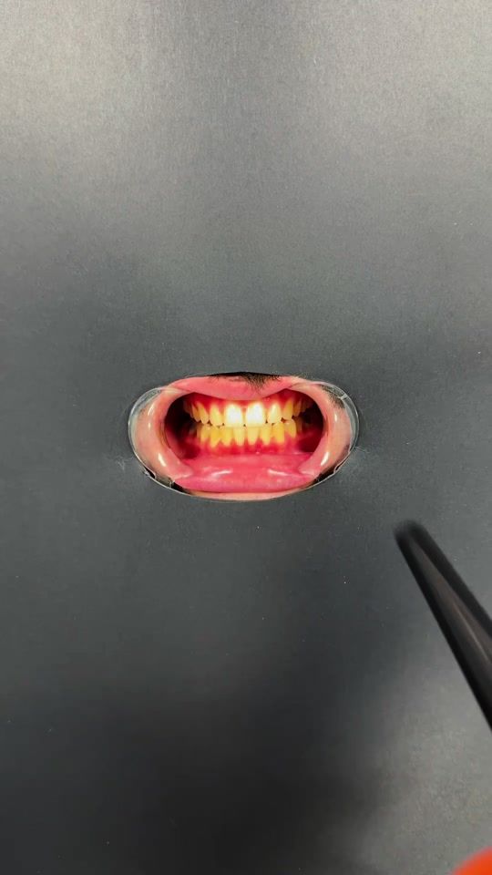 TikTok video thumbnail by whites_smiles