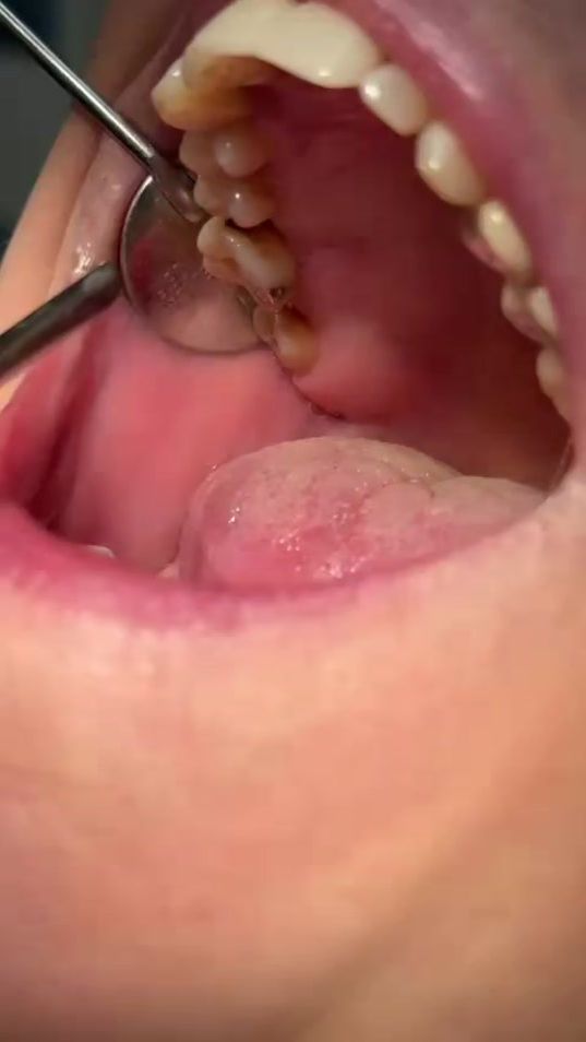 TikTok video thumbnail by aerdnailosnoc