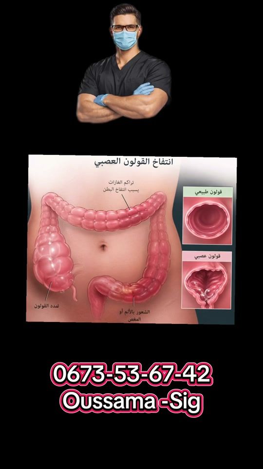 TikTok video thumbnail by abedmohamedoussama