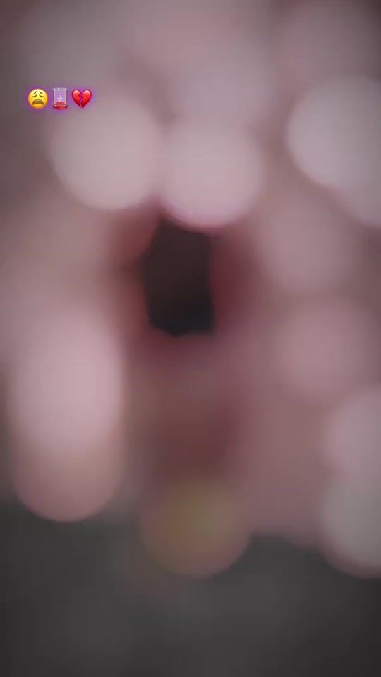 TikTok video thumbnail by mati_eri_boy
