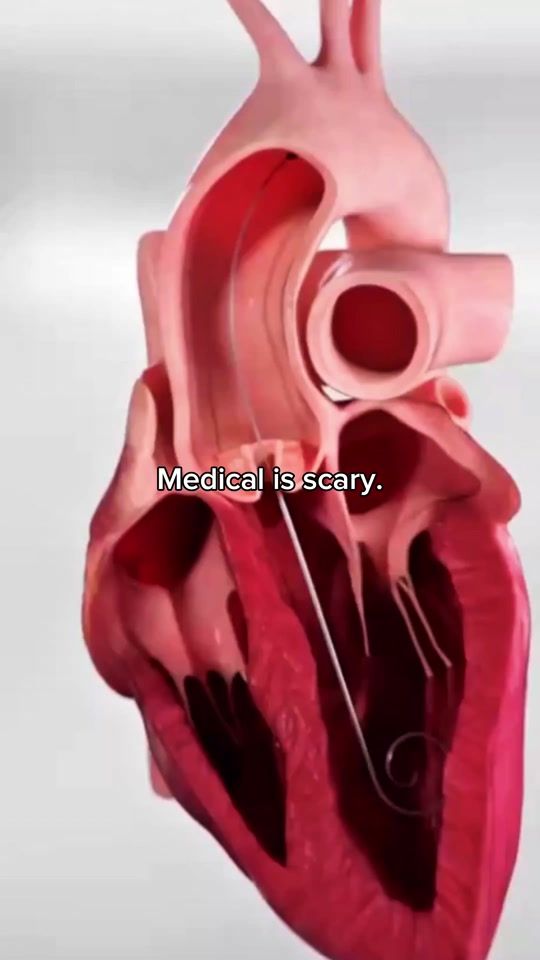 TikTok video thumbnail by rapidscience