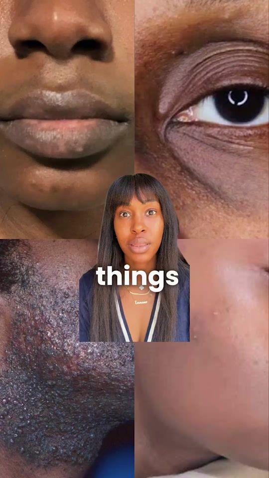 TikTok video thumbnail by skinfiltrator