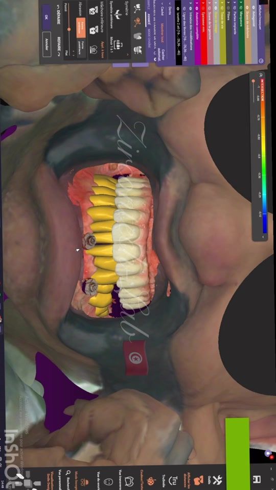 TikTok video thumbnail by zircontechlab