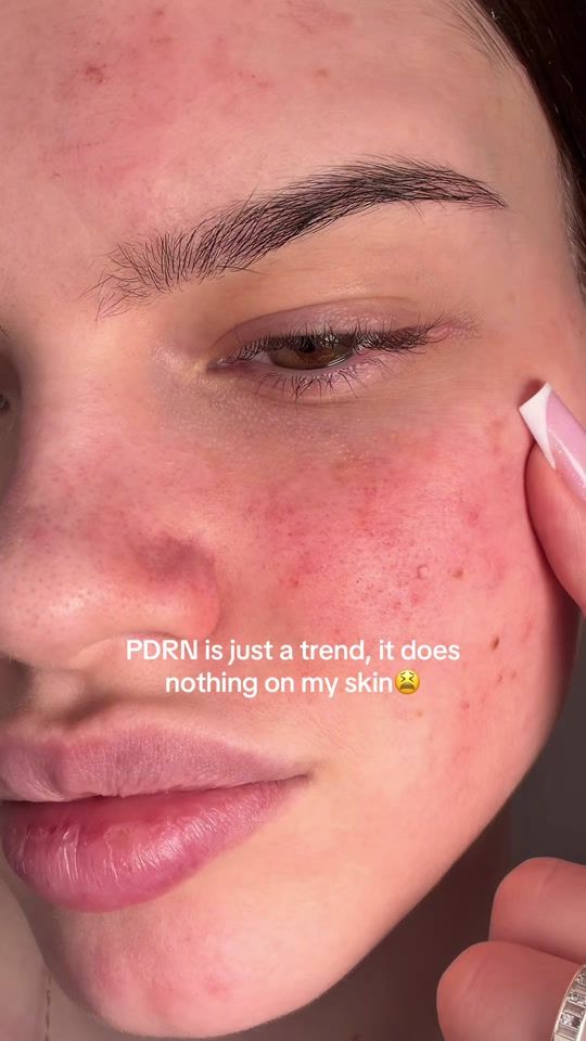TikTok video thumbnail by glownastzy