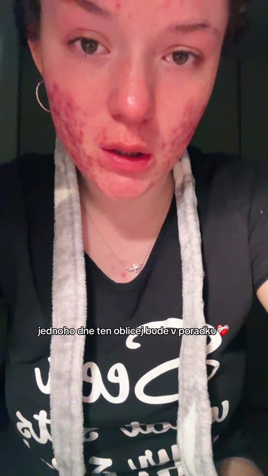 TikTok video thumbnail by p3covaa.m