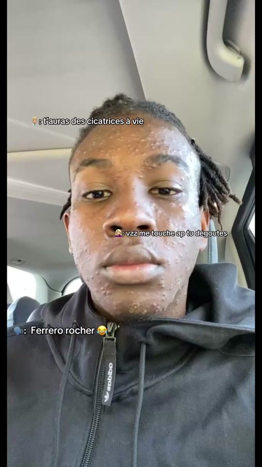 TikTok video thumbnail by drk_0001