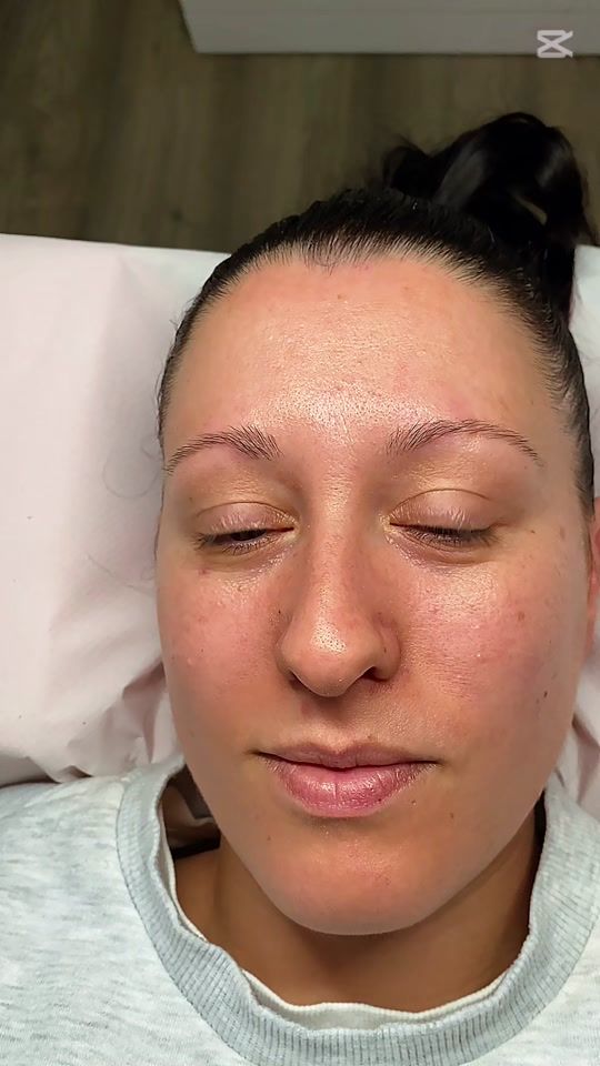 TikTok video thumbnail by aurea.centrodeestetica