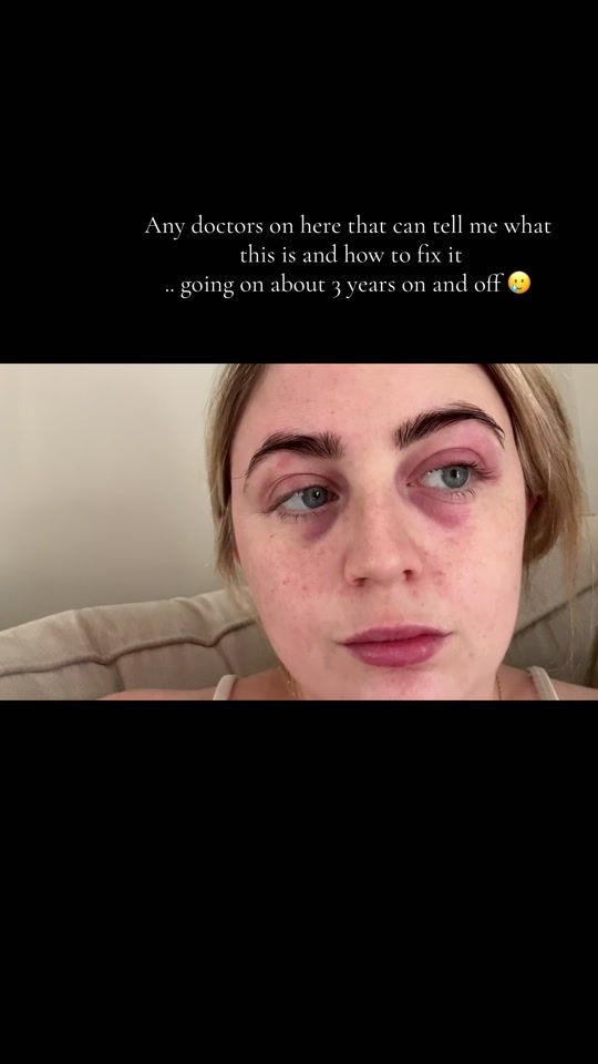 TikTok video thumbnail by sarahleeoconnell