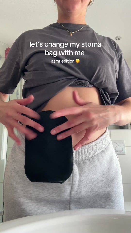 TikTok video thumbnail by stomatalk.mitjuli