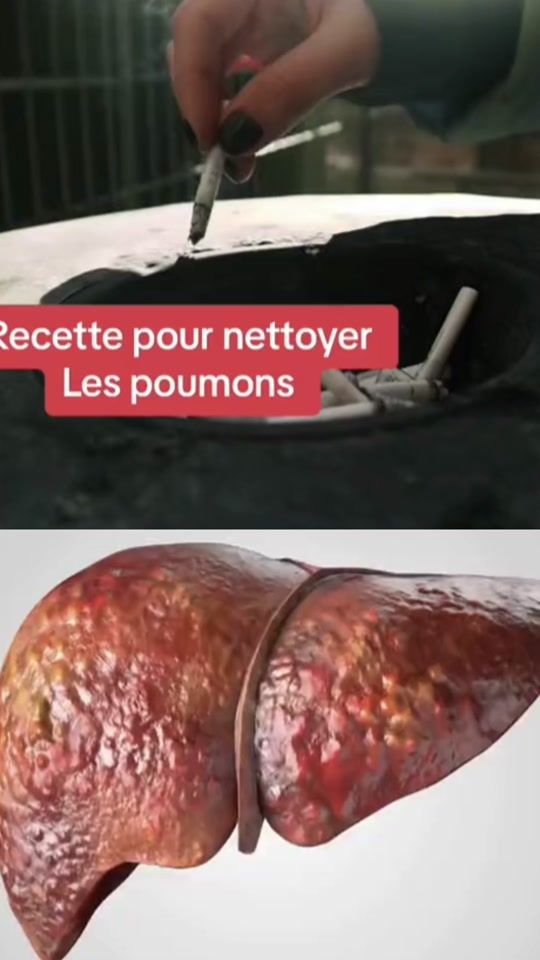 TikTok video thumbnail by good_vibe_astuce