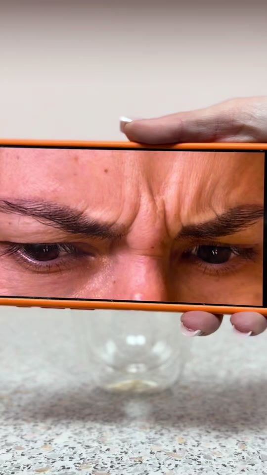 TikTok video thumbnail by dr.ralucaharnagea