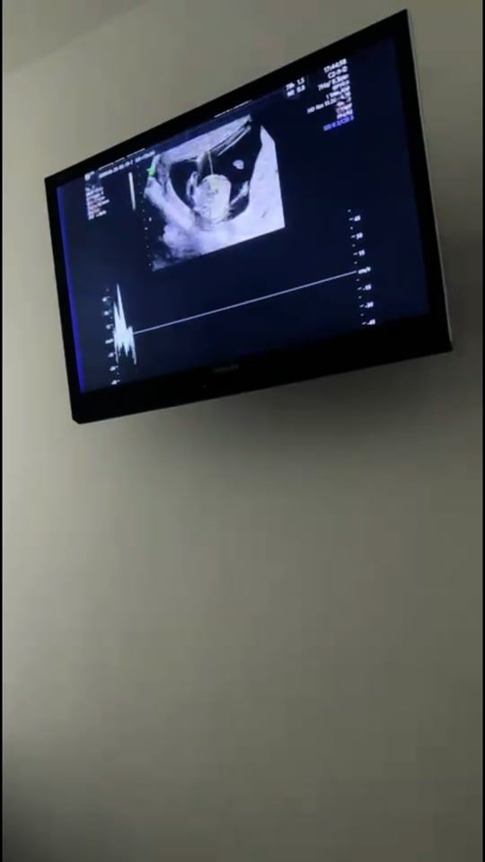TikTok video thumbnail by merylanddd