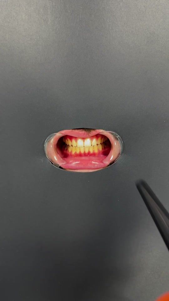 TikTok video thumbnail by whites_smiles