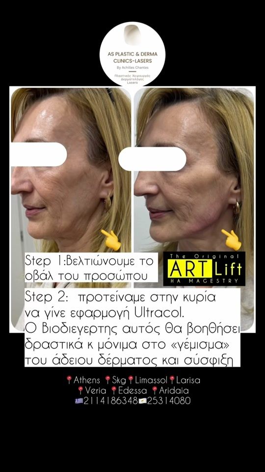 TikTok video thumbnail by asplasticanddermaclinics