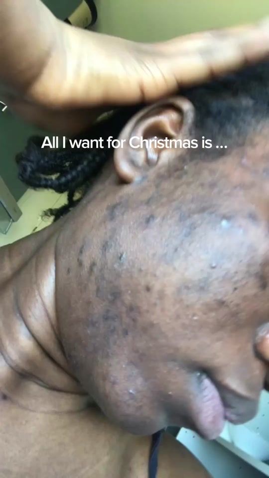 TikTok video thumbnail by abdbeauty