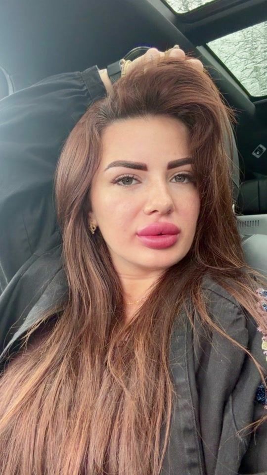 TikTok video thumbnail by mardaledenisa4